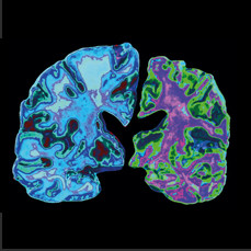 Чашечки для наполнителя Чашечка для бонга